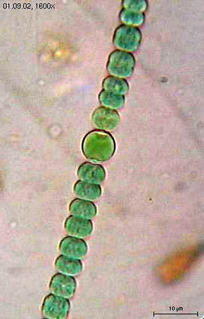 290px-Anabaena_sperica2.jpg 290px-Anabaena_sperica2.jpg