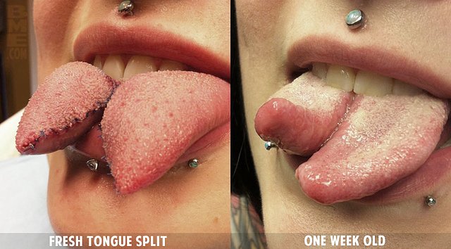 tongue-split-healing.jpg tongue-split-healing.jpg