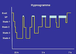 Cliquez sur l'image pour la voir en taille relle

Nom : hypnogramme.jpg
Taille : 939x664
Poids : 30,0 Ko
ID : 65285