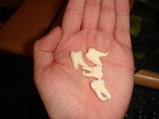 Cliquez sur l'image pour la voir en taille relle

Nom : DENTS DE SAGESSE.JPG
Taille : 922x692
Poids : 57,9 Ko
ID : 56276