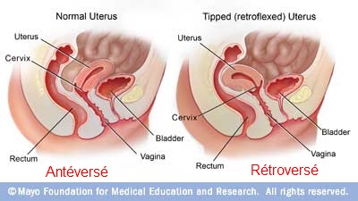 uterus-19369b8.jpg uterus-19369b8.jpg
