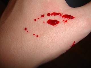 morsure.jpg morsure.jpg