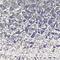 Crystalius