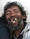 Mankhune-dent
