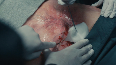 Pas besoin d'être docteur en médecine pour savoir que là-dedans il y a un truc dégueulasse